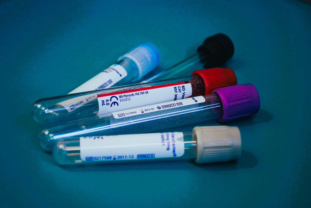 immagine di provette